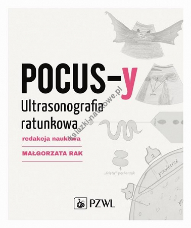 POCUS-y Ultrasonografia ratunkowa