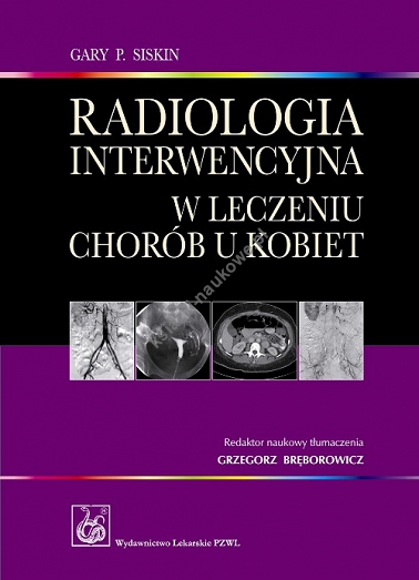 Radiologia interwencyjna w leczeniu chorób u kobiet